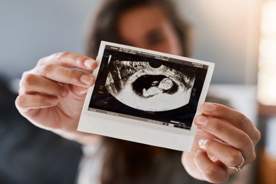 Eine Frau hält ein Ultraschallbild .